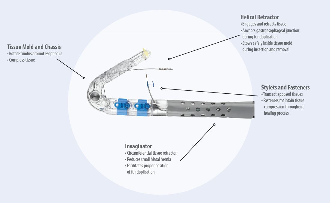 EsophyX® Device EndoGastric Solutions