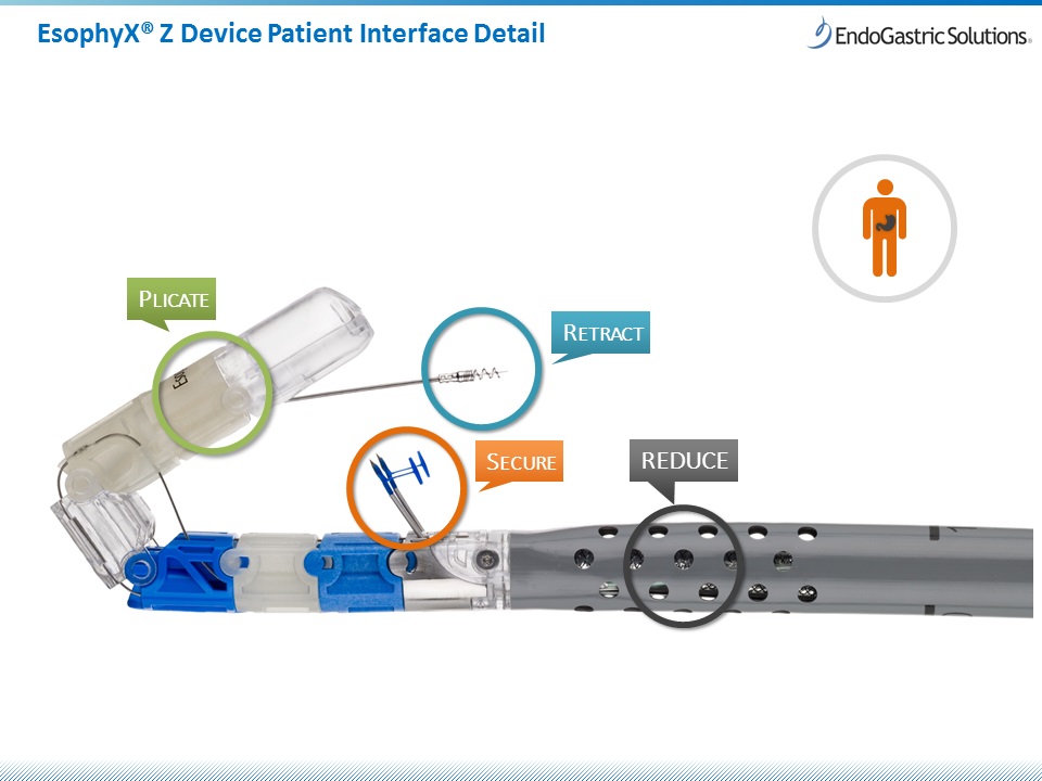 EsophyX device patient interface