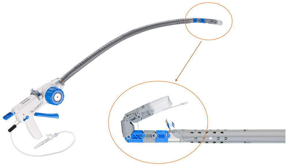 EsophyX Z+ model device with close up of tissue mold 