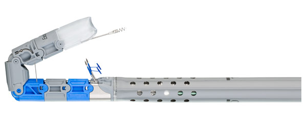 EndoGastric® Solutions Debuts EsophyX® Z+ Device for Transoral Incisionless Fundoplication (TIF) Procedures